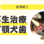 62_再生治療　下顎犬歯